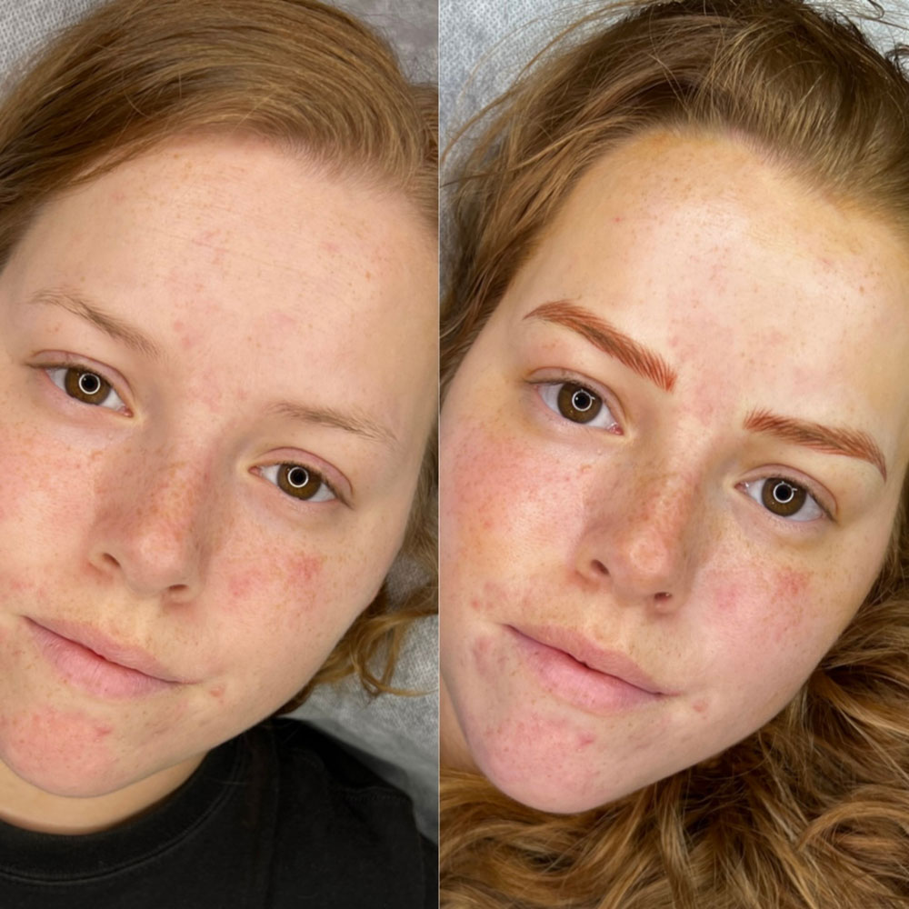 COMBO-BROWS-(1)